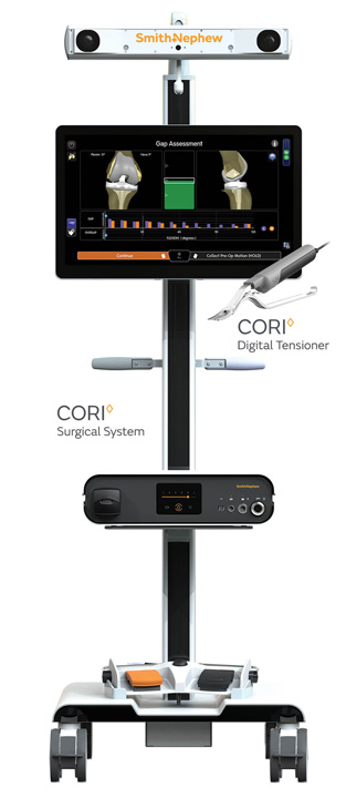 Robotic Technology: Intel for the OR | Outpatient Surgery Magazine